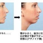 レス141番の画像1