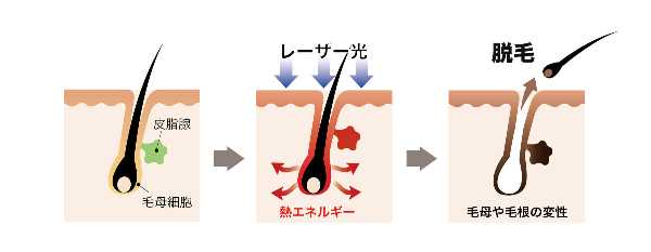 記事サムネイル