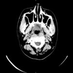 レス57番の画像1